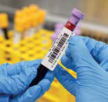 Лабораторная маркировка